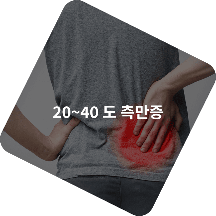 20~40도 측만증 사례를 보여주는 이미지